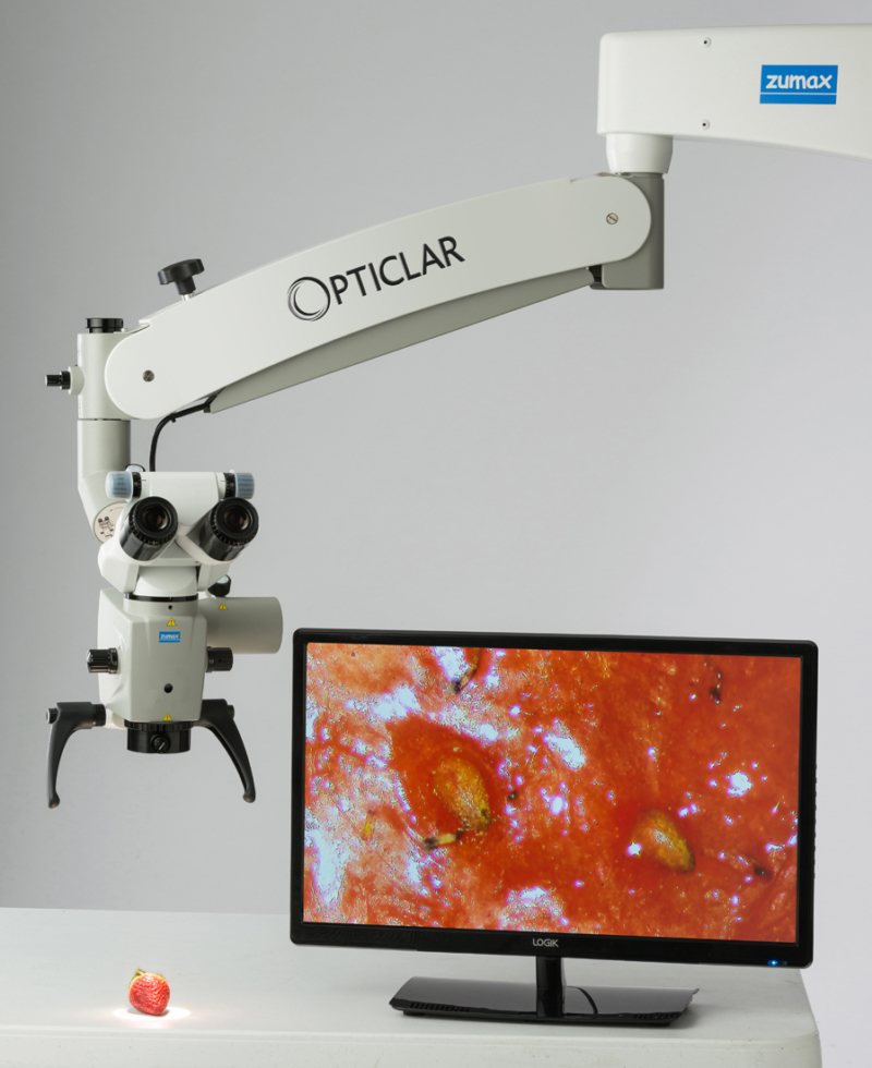 Dental Microscope Strawberry Examination 3