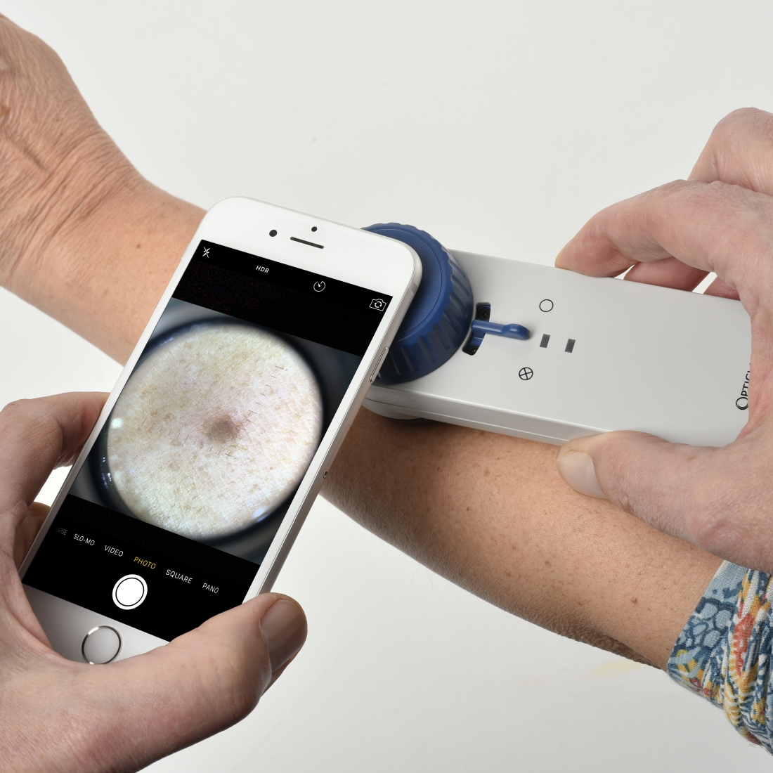 Smartphone Connectors for Compact D-Scope Dermatoscope - OpticlarOpticlar